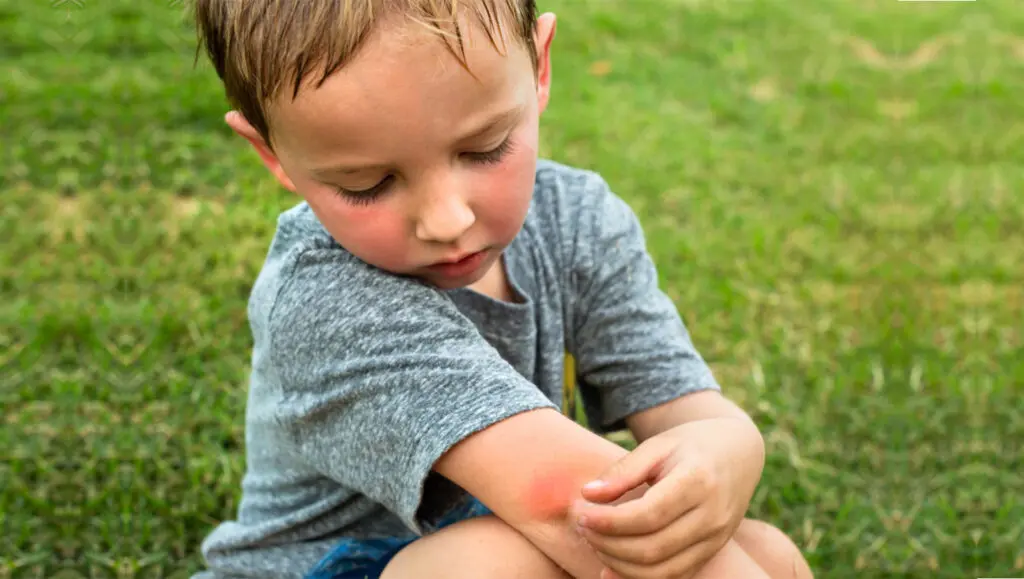 Why This Summer's Humidity Is Making Mosquitoes So Much Worse