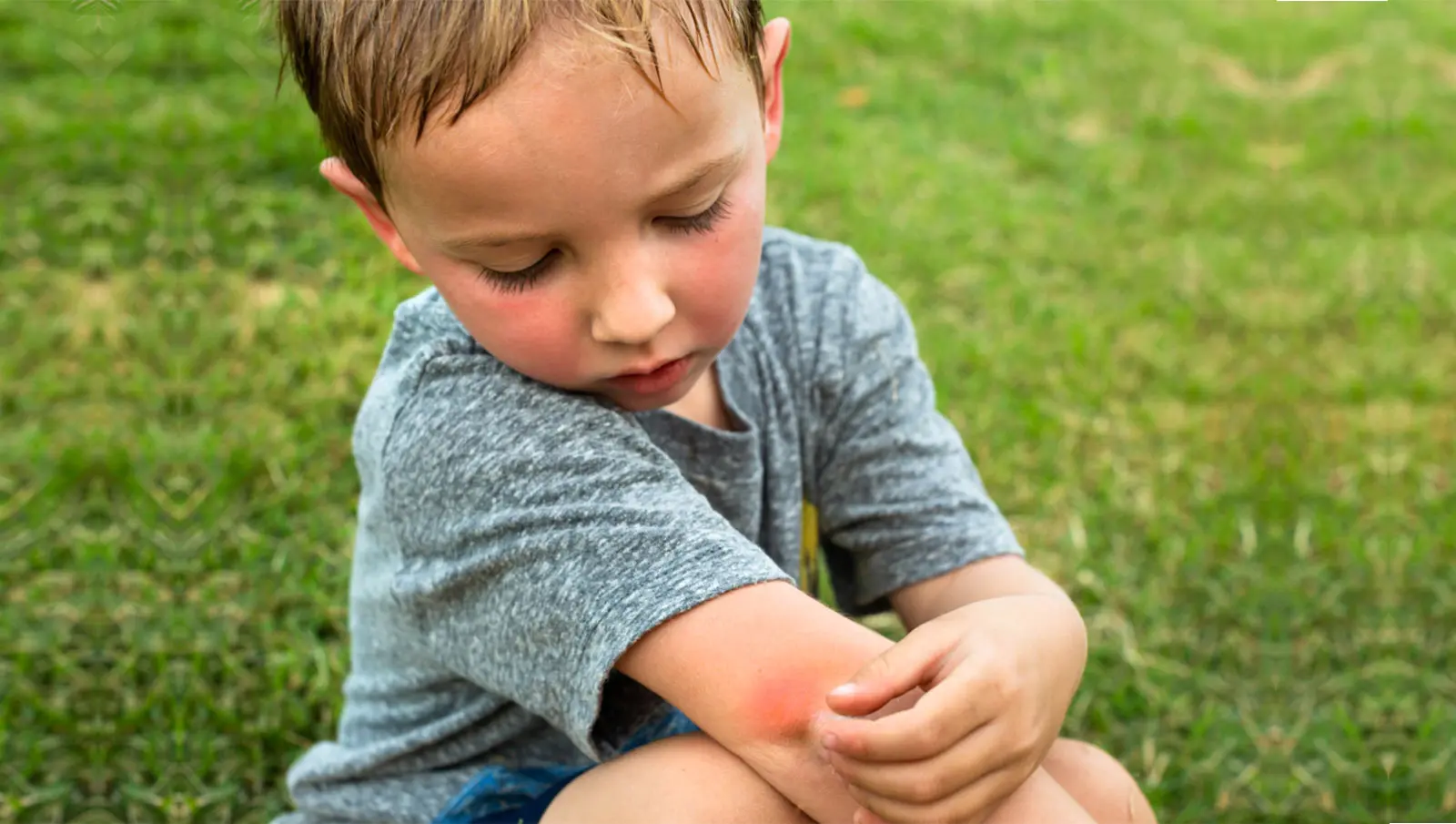 Why This Summer's Humidity Is Making Mosquitoes So Much Worse